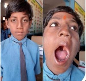  चिकित्सा के क्षेत्र में आयुष्मान और चिरायु योजना से नौनिहालों को मिल रहा जीवनदान