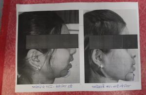 संभाग का पहला टी.जे.आर. और ऑर्थो-ग्रेथिक सर्जरी संभाग का पहला टी.जे.आर. और ऑर्थो-ग्रेथिक सर्जरी