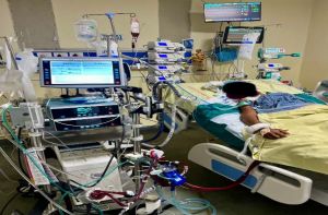  एम्स ने छत्तीसगढ़ में किया पहला सफल वीए-ईसीएमओ केस