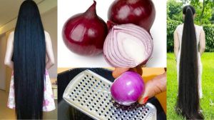 प्याज से बाल कैसे बढ़ाएं? जानें 5 तरीके 