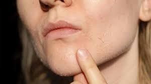  दाग-धब्बों के साथ ढीली हो रही स्किन तो शुरू कर दें ये सीरम लगाना