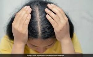  35 का होते ही महिलाओं के क्यों झड़ने लगते बाल? ये हैं 5 वजह और उपचार