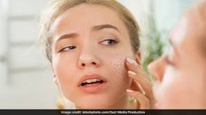   प्रदूषण ने छीन ली है चेहरे की चमक तो इन बातों का रखें ख्याल -शहनाज़ हुसैन