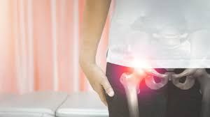 सर्दियों में क्यों जाम होने लगते हैं आपके कूल्हे? सर्दियों में क्यों जाम होने लगते हैं आपके कूल्हे?