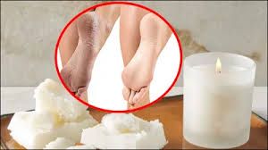 फटी एड़ियों के लिए घर में बनाकर रख लें वैक्स क्रीम फटी एड़ियों के लिए घर में बनाकर रख लें वैक्स क्रीम