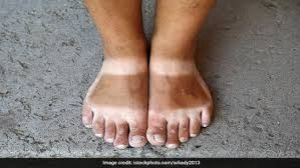 पैरों में दिख रहा कालापन और गंदगी को इन आसान तरीकों से करें साफ