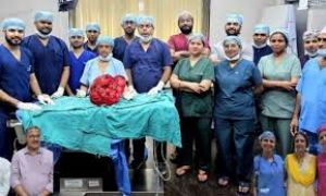 सफदरजंग अस्पताल में चिकित्सकों ने मरीज के पेट से 10 किलोग्राम वजन का ट्यूमर निकाला सफदरजंग अस्पताल में चिकित्सकों ने मरीज के पेट से 10 किलोग्राम वजन का ट्यूमर निकाला